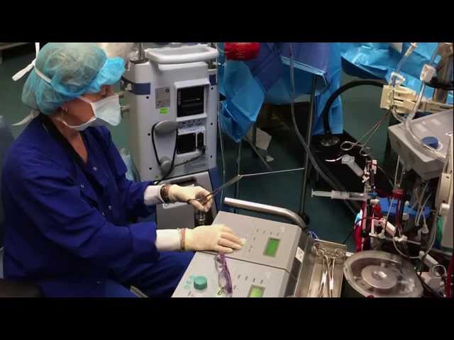 Mindy's Story.A Day in the Life of a Perfusionist.Peter Munk Cardiac Centre