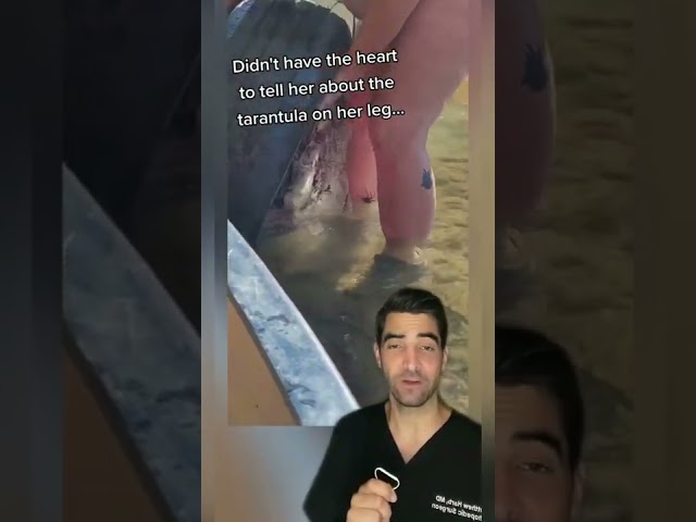 Spider Bite