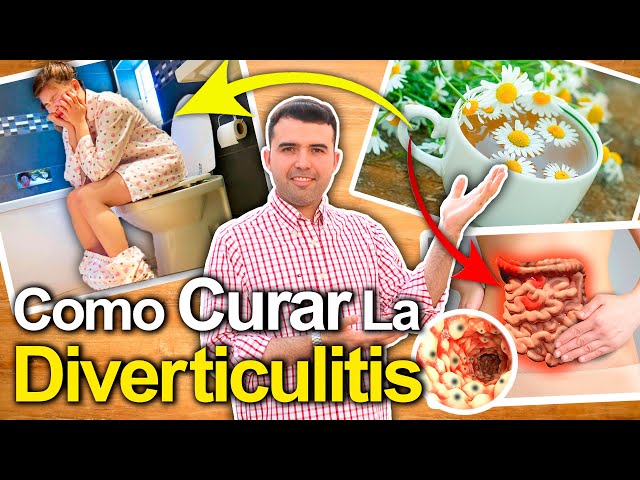How to Treat Diverticulitis? - What It Is and How to Get Rid of Diverticula or Diverticulosis