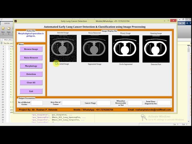 Lung Cancer Detection and Classification Using Image Processing Matlab Code Lung Cancer Prediction