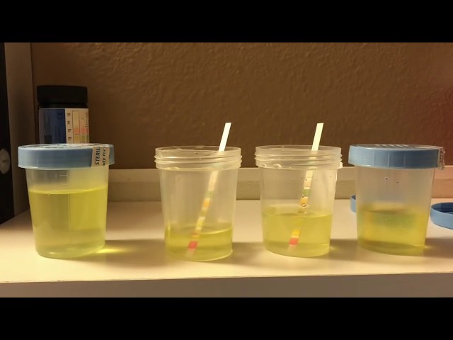 How To Detect Synthetic Urine ( QuickFix )