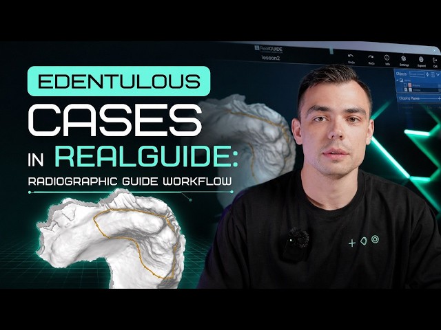 Edentulous Cases in RealGUIDE: Radiographic Guide Workflow