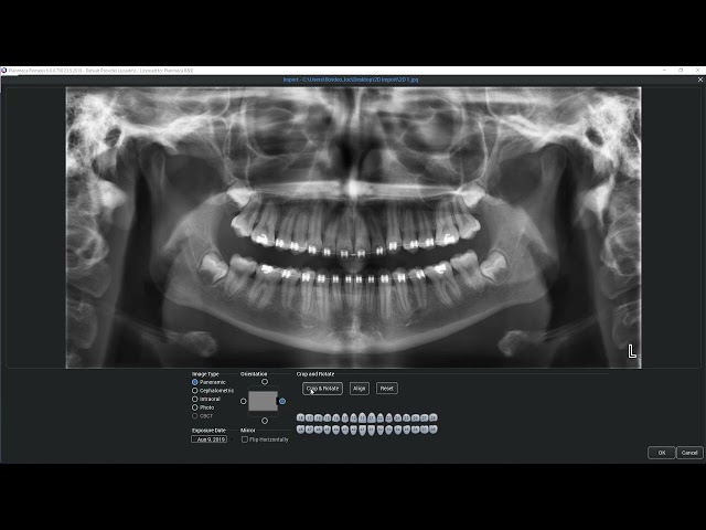 How to – Import a 2D image into Planmeca Romexis