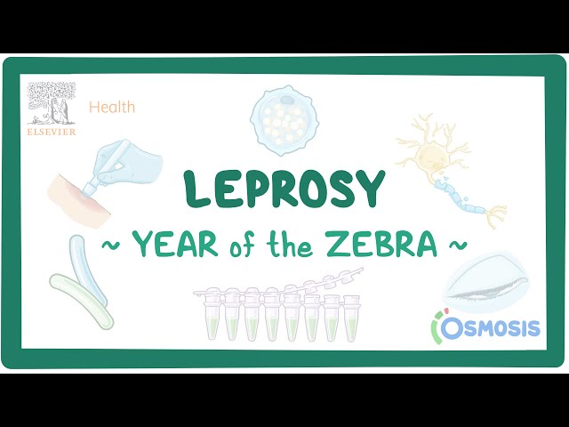 Leprosy (Year of the Zebra)