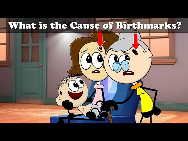 What is the Cause of Birthmarks? + more videos | #aumsum #kids #cartoon #science