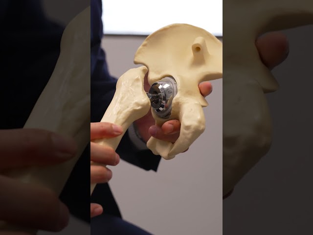 Applying For An #Orthopedic Fellowship? What To Know