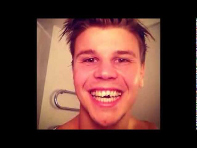 Langerak says goodbye to the teeth - Langerak saluta i suoi denti ( Portiere Borussia Dortmund )