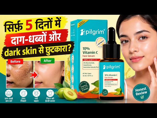 Pilgrim 10% Vitamin C Face Serum Review | Will It Really Give a Glow and Reduce Dark Spots in 5 D...