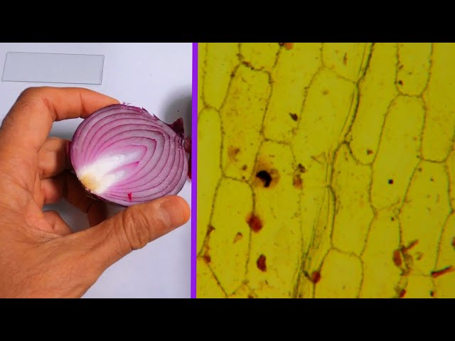 Onion Cells Under the Microscope