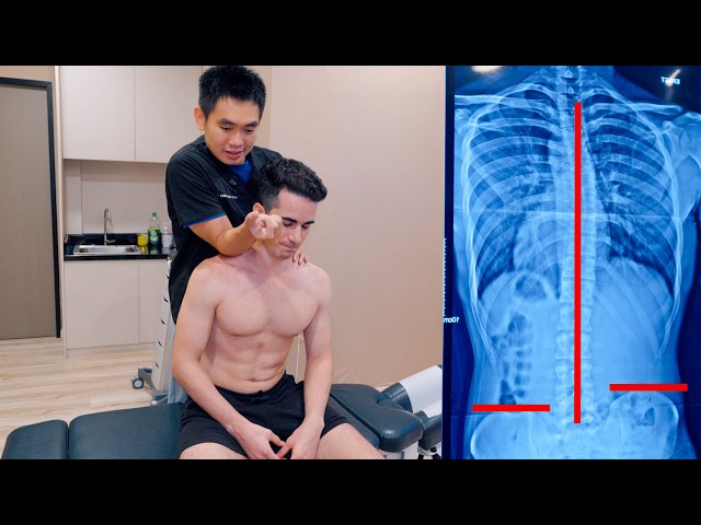 ASMR: Deep Spine Chiropractic Adjustment and Neck Cracking for Scoliosis Relief