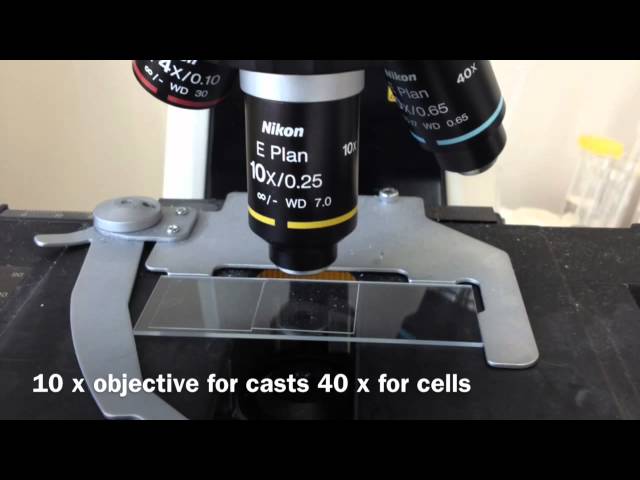 Iphone urine microscopy