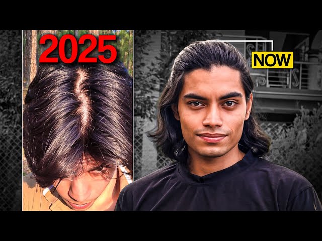 my hair regrowth (1 year later)