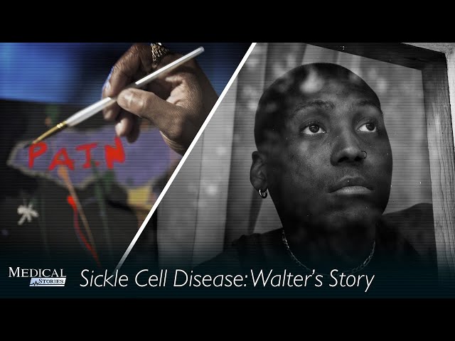 Medical Stories - Sickle Cell: Walter’s Story