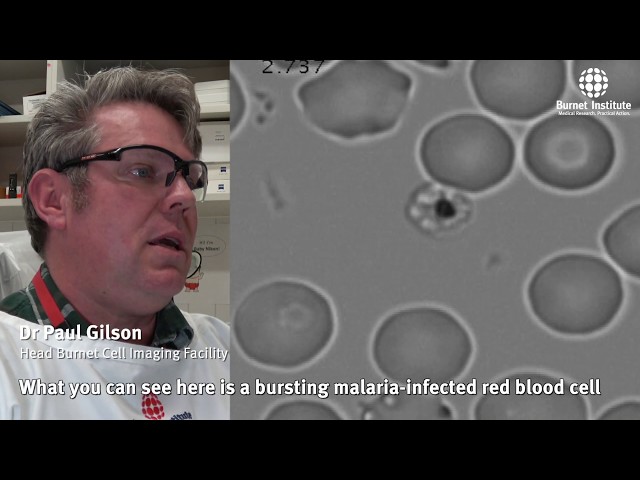 Malaria parasites invading human red blood cell