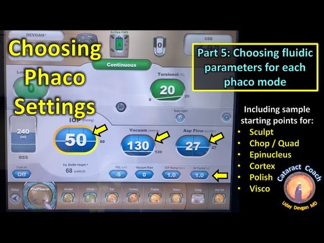 Phaco Fundamentals Part 5: Choosing Fluidic Parameters for Cataract Surgery