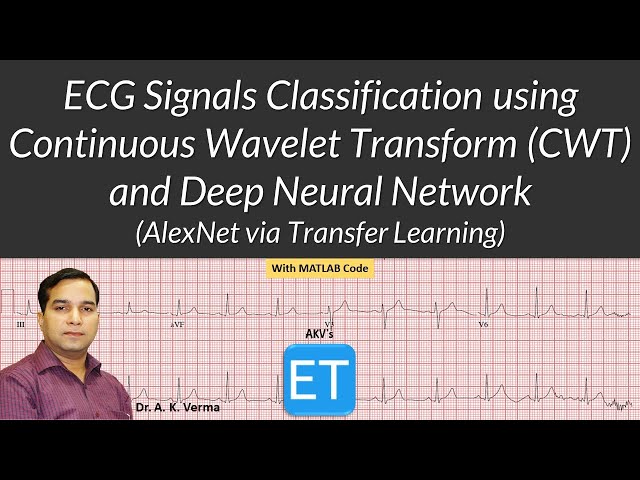 ECG Signals Classification using Continuous Wavelet Transform (CWT) and Deep Neural Network