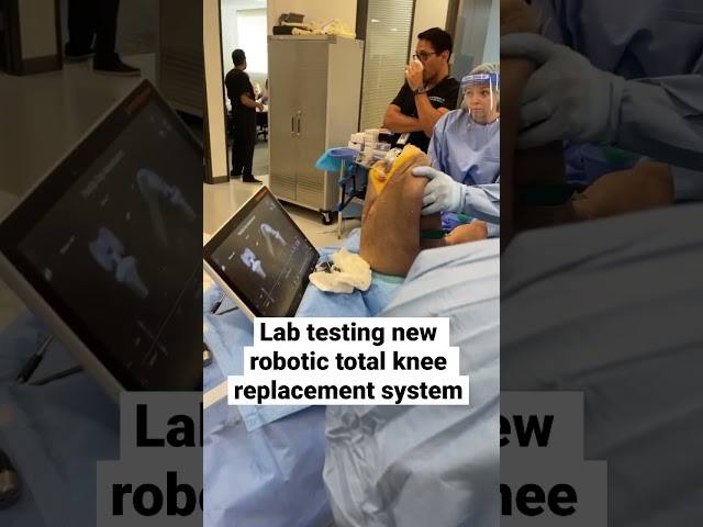 Robotic Total Knee Replacement Surgery #shorts #arthritis #orthopedics #sportsmedicine