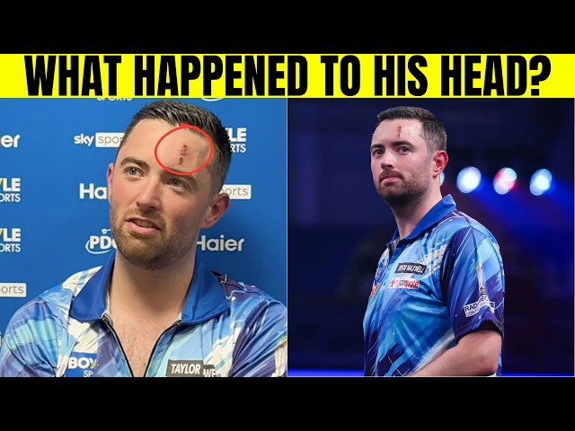 Luke Humphries Reveals Cause of Scar-Like Mark on His Head After Bullseye Filming