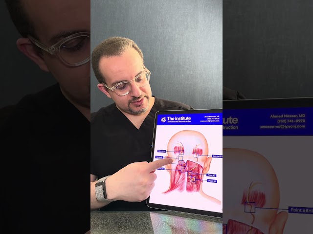 How do you decompress the occipital nerve? By Dr. Nasser (Instagram: nasserplasticsurgery)