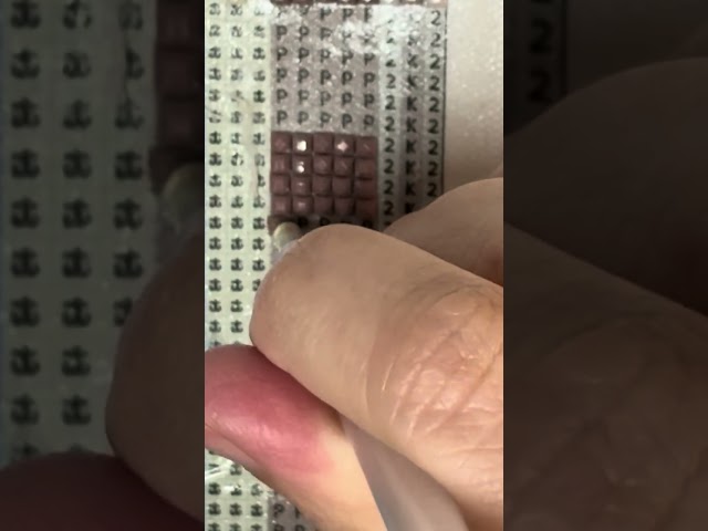 A Glimpse of Healing: The Diamond Placement Process