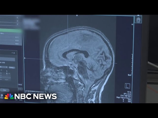New technology offers hope for Parkinson’s patients