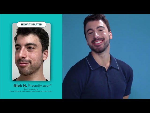 Ditch the filters, try Proactiv!