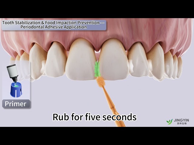 EasyFix Periodontal Adhesive- Instruction for Use 