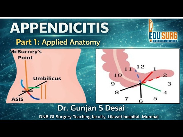 Acute Appendicitis Part 1 | High Yield Applied Anatomy for NEET PG MRCS USMLE