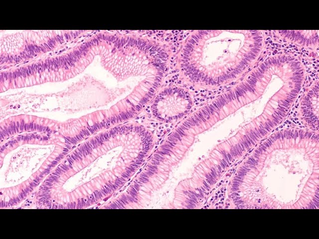 What is HISTOLOGY?