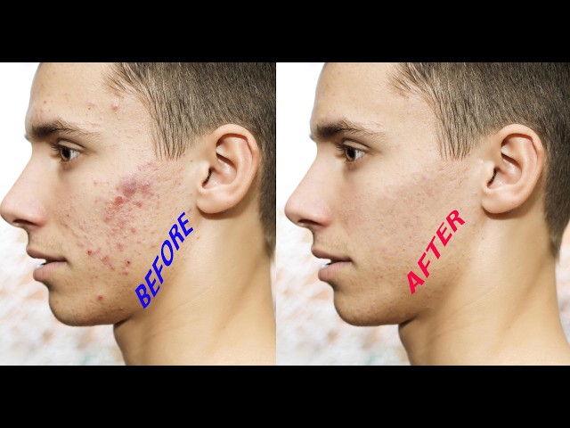 Spot Remove In Photoshop | How to remove Spot in Photoshop