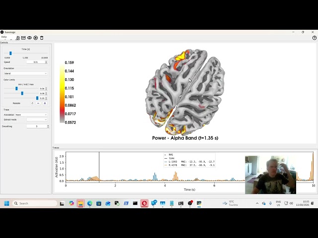 What happens when idiot and GPT 56 begin to think about neurobiology. A ramble.