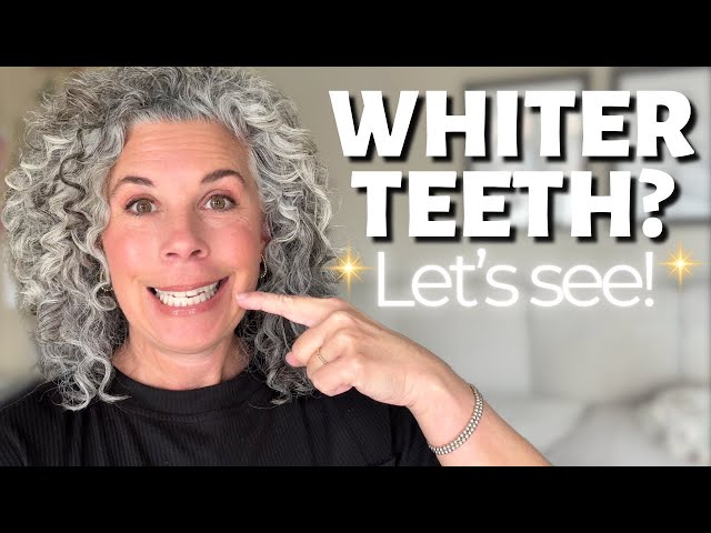 I Bought the Best-Selling Teeth Whitener & Tried It At Home.  Did it REALLY Work?