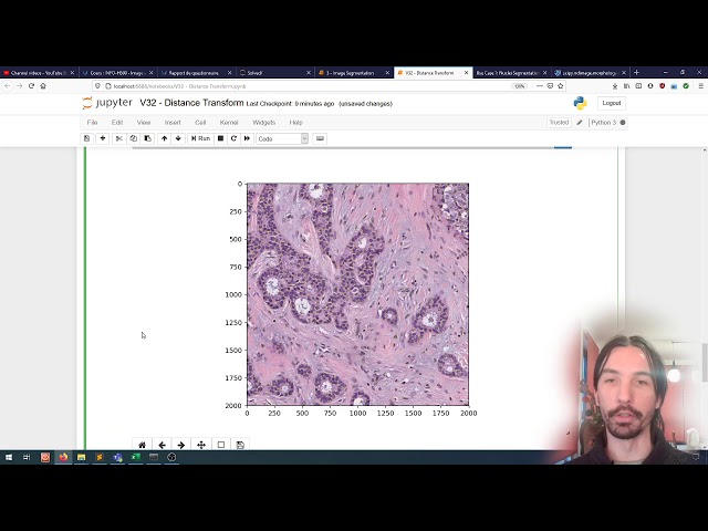 Image processing (32) | Image Segmentation | Distance transform