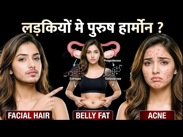 How I Cured My Hormonal Imbalance & PCOS Naturally (Without Medicines)