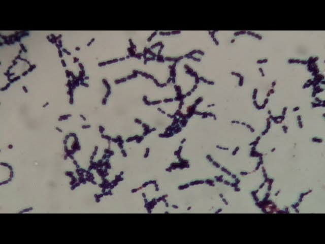 Gemella in Gram Staining of Culture Microscopy