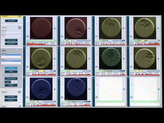IVI - Un algoritmo exclusivo mejora las tasas de gestación del Embryoscope (España, 2015)