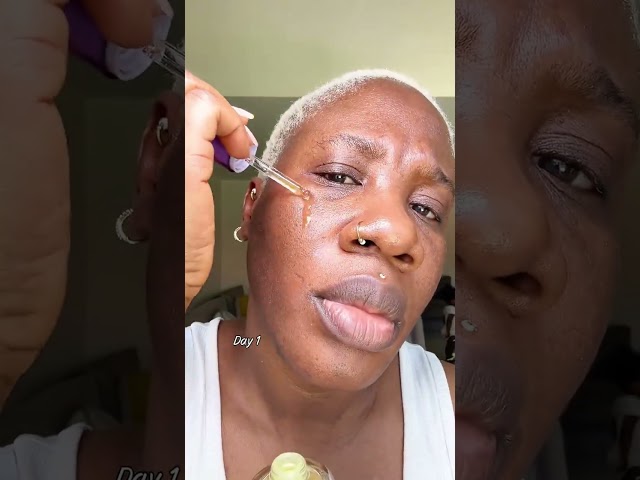 One drop, wrinkles out with consistent use, results can be seen