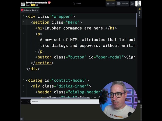 Invoker commands 😍