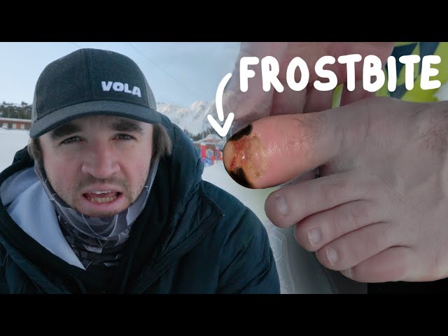 I Got Frostbite in Austria… And Still Had to Train