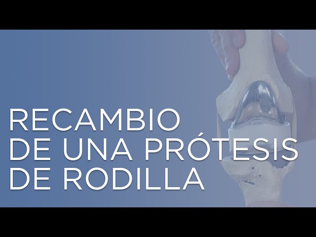 Recambio de una prótesis de rodilla  ¿Por qué hay que cambiar la prótesis de rodilla?