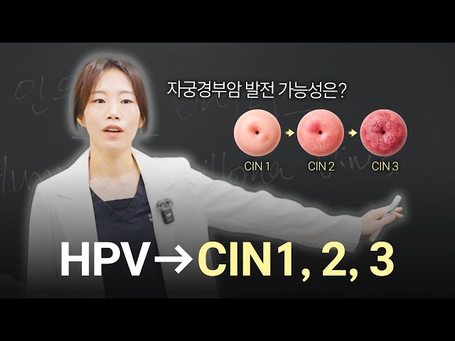 I tested positive for HPV, does this mean I have cancer? An OB-GYN explains the truth about CIN s...
