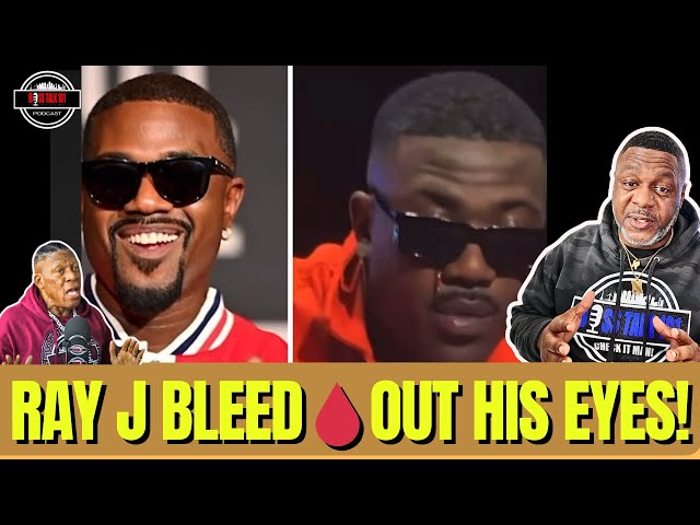 BREAKING! Ray J Bleed Out Of His Eyes! This Bad!
