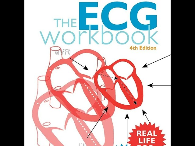 The ECG Workbook