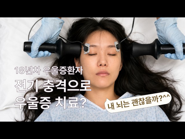 ECT 치료 후기 | 전기경련치료