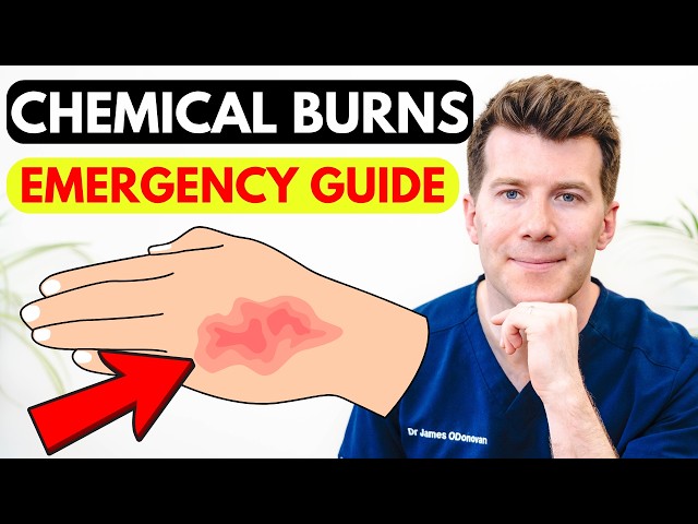 Chemical Burn Explained – Fast Facts for First Aid & Recovery