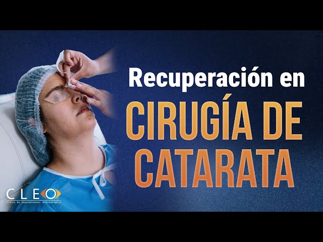 Cuidados Iniciales Después de Cirugía de Catarata: Aplicación Correcta de Gotas | Oftalmólogo Mich.