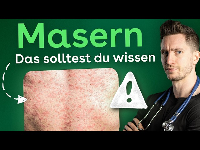 Measles: Why cases are rising again