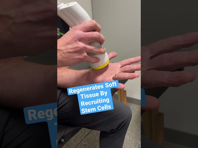 ELIMINATE HAND PAIN with SoftWave Therapy ⚡️