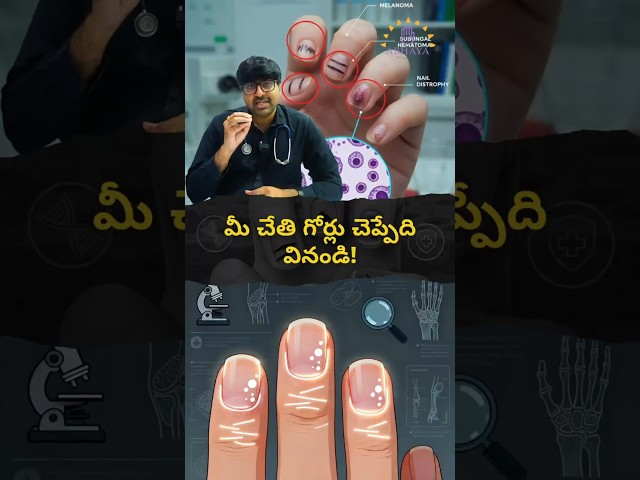 Fingernail Changes That Reveal Hidden Diseases| Dr. Udaykumar Punukollu| Best Cancer Specialist