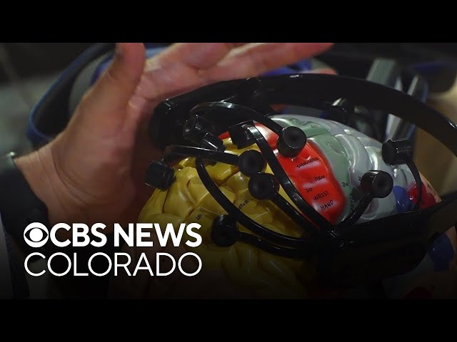 What’s the age of your brain? Neurotechnology study by a Colorado doctor has the answer